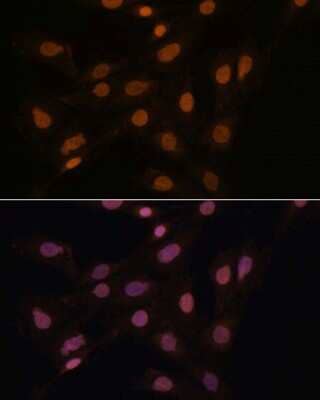 <b>Genetic Strategies Validation. </b>Immunocytochemistry/Immunofluorescence: CBX3 Antibody [NBP2-92962] - Immunofluorescence analysis of C6 cells using HP1 gamma/CBX3 antibody (NBP2-92962) at dilution of 1:100. Blue: DAPI for nuclear staining.