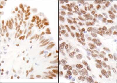 Immunohistochemistry: CBX3 Antibody [NB100-41429] - Sample: FFPE section of human ovarian carcinoma (left) and mouse teratoma (right). Antibody: Affinity purified rabbit anti-CBX3 used at a dilution of 1:5,000 (0.2ug/ml). Detection: DAB staining using Immunohistochemistry Accessory Kit.