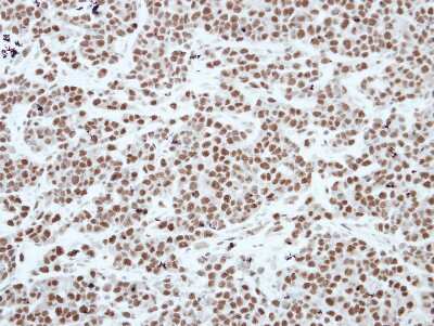 Immunohistochemistry-Paraffin: CBX3 Antibody [NBP2-15736] - Immunohistochemical analysis of paraffin-embedded TOV-21G xenograft, using antibody at 1:250 dilution.