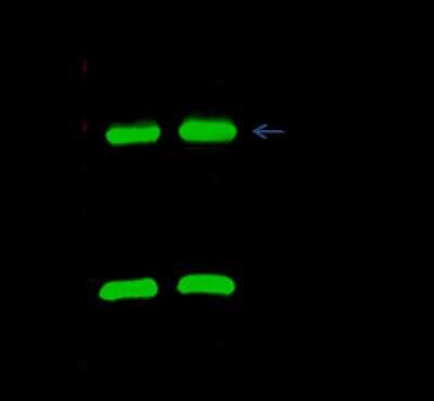 Immunoprecipitation: CBX3 Antibody [NBP2-98758] - CBX3 was immunoprecipitated using: Lane A: 0.5 mg Hela Whole Cell Lysate. Lane B: 0.5 mg A549 Whole Cell Lysate 2 ul anti-CBX3 rabbit polyclonal antibody and 15 ul of 50 % Protein G agarose. Primary antibody: Anti-CBX3 rabbit polyclonal antibody, at 1:200 dilution. Secondary antibody: Dylight 800-labeled antibody to rabbit IgG (H+L), at 1:5000 dilution. Developed using the Odyssey technique. Performed under reducing conditions. Predicted band size: 20 kDa. Observed band size: 20 kDa