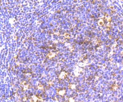 Immunohistochemistry-Paraffin: CBX3 Antibody (JU81-36) [NBP2-75432] - Analysis of paraffin-embedded human tonsil tissue using anti-HP1 gamma antibody. Counter stained with hematoxylin.