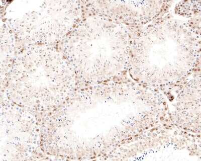Immunohistochemistry-Paraffin: CBX3 Antibody (JU81-36) [NBP2-75432] - Analysis of paraffin-embedded mouse testis tissue using anti-CBX3 antibody. The section was pre-treated using heat mediated antigen retrieval with sodium citrate buffer (pH 6.0) for 20 minutes. The tissues were blocked in 5% BSA for 30 minutes at room temperature, washed with ddH2O and PBS, and then probed with the primary antibody (1/200) for 30 minutes at room temperature. The detection was performed using an HRP conjugated compact polymer system. DAB was used as the chromogen. Tissues were counterstained with hematoxylin and mounted with DPX.