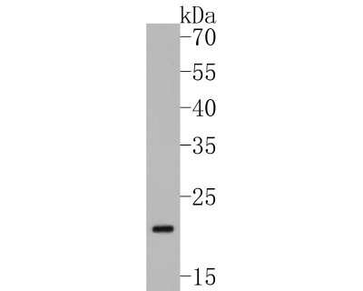 Western Blot: CBX3 Antibody (JU81-36) [NBP2-75432] - Analysis of CBX3 on mouse colon tissue lysates. Proteins were transferred to a PVDF membrane and blocked with 5% BSA in PBS for 1 hour at room temperature. The primary antibody (1/500) was used in 5% BSA at room temperature for 2 hours. Goat Anti-Rabbit IgG - HRP Secondary Antibody at 1:200,000 dilution was used for 1 hour at room temperature.