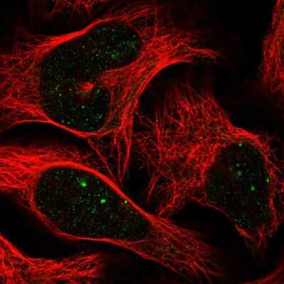 Immunocytochemistry/Immunofluorescence: CBX4 Antibody [NBP2-55246] - Staining of human cell line U-2 OS shows localization to nuclear bodies.