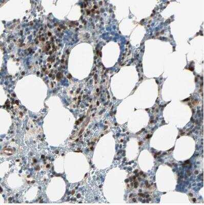 Immunohistochemistry-Paraffin: CBX4 Antibody [NBP1-83225] - Staining of human bone marrow shows strong nuclear positivity in subset of hematopoietic cells.