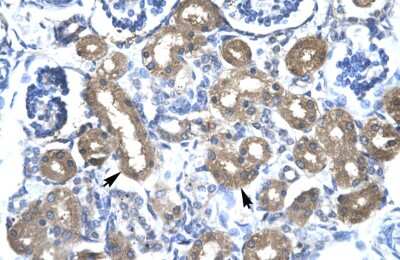 Immunohistochemistry-Paraffin: CBX4 Antibody [NBP3-10881] - Immunohistochemical analysis of paraffin-embedded human kidney tissue.