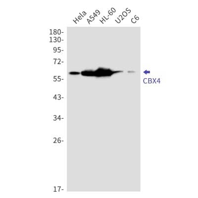 Western Blot: CBX4 Antibody (S08-4I3) [NBP3-19845] - Western blot detection of CBX4 in Hela, A549, HL-60, U2OS, C6 cell lysates using NBP3-19845 (1:1000 diluted). Predicted band size: 61kDa. Observed band size: 61kDa.