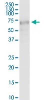 Western Blot: CBX4 Antibody [H00008535-B01P] - Analysis of CBX4 expression in human placenta.