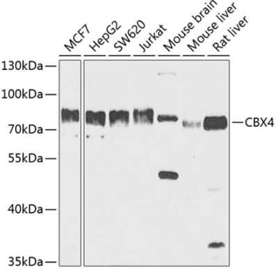 Western Blot: CBX4 Antibody [NBP2-92934] - Analysis of extracts of various cell lines, using CBX4 at 1:1000 dilution.Secondary antibody: HRP Goat Anti-Rabbit IgG (H+L) at 1:10000 dilution.Lysates/proteins: 25ug per lane.Blocking buffer: 3% nonfat dry milk in TBST.Detection: ECL Basic Kit .Exposure time: 60s.