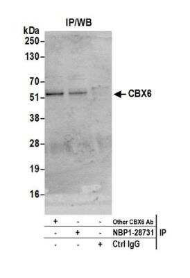 Immunoprecipitation: CBX6 Antibody [NBP1-28731] - Detection of human CBX6 by western blot of immunoprecipitates. Samples: Whole cell lysate (1.0 mg per IP reaction; 20% of IP loaded) from HeLa cells prepared using NETN lysis buffer. Antibodies: Affinity purified rabbit anti-CBX6 antibody NBP1-28731 used for IP at 3 ug per reaction. CBX6 was also immunoprecipitated by another rabbit anti-CBX6 antibody. For blotting immunoprecipitated CBX6, NBP1-28731 was used at 1 ug/ml. Detection: Chemiluminescence with an exposure time of 30 seconds.