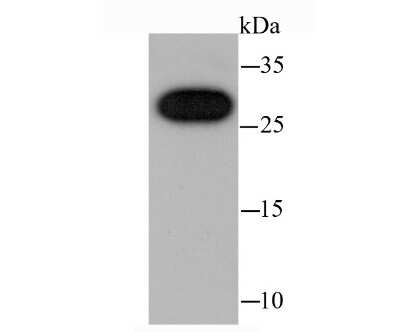Western Blot: CBX7 Antibody (JM44-63) [NBP2-75433] - Analysis of cbx7 on A431 cell using anti-cbx7 antibody at 1/1,000 dilution.
