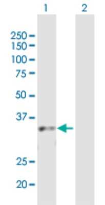 Western Blot: CBX7 Antibody [H00023492-B01P] - Analysis of CBX7 expression in transfected 293T cell line by CBX7 polyclonal antibody.  Lane 1: CBX7 transfected lysate(27.61 KDa). Lane 2: Non-transfected lysate.