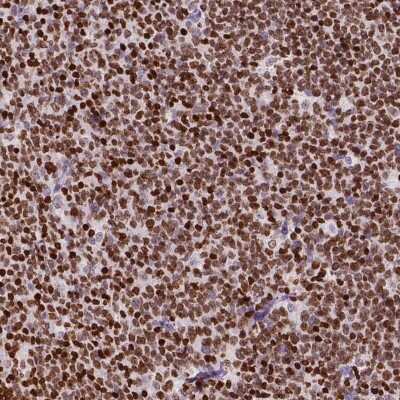 Immunohistochemistry-Paraffin: CBY3 Antibody [NBP2-49578] - Staining of human tonsil shows moderate nuclear positivity in germinal center cells.