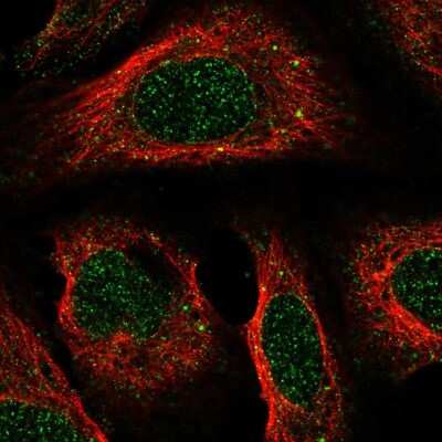 Immunocytochemistry/Immunofluorescence: CC Chemokine Receptor D6 Antibody [NBP2-57954] - Staining of human cell line U-2 OS shows localization to nucleoplasm, nuclear membrane & vesicles.