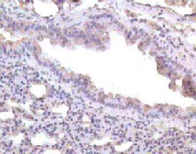 Immunohistochemistry: CC Chemokine Receptor D6 Antibody [NB100-703] - Antibody to mouse beta chemokine receptor D6 on paraffin section of mouse lung