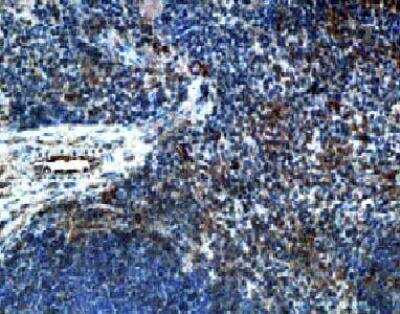 Immunohistochemistry: CC Chemokine Receptor D6 Antibody [NB100-703] - Antibody to mouse beta chemokine receptor D6 on paraffin section of mouse spleen.