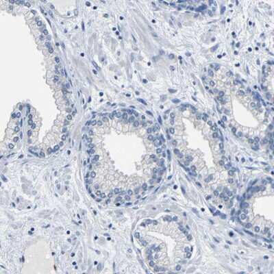 Immunohistochemistry-Paraffin: CC Chemokine Receptor D6 Antibody [NBP1-88150] - Staining of human prostate shows low expression as expected.