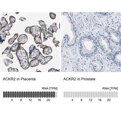 Immunohistochemistry-Paraffin: CC Chemokine Receptor D6 Antibody [NBP1-88150] - Staining in human placenta and prostate tissues using anti-ACKR2 antibody. Corresponding ACKR2 RNA-seq data are presented for the same tissues.