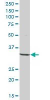 Western Blot: CC Chemokine Receptor D6 Antibody [H00001238-B01P] - Analysis of CCBP2 expression in human placenta.