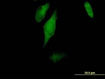 Immunocytochemistry/Immunofluorescence: CC2D1A Antibody [H00054862-B01P] - Analysis of purified antibody to CC2D1A on HeLa cell. (antibody concentration 10 ug/ml)