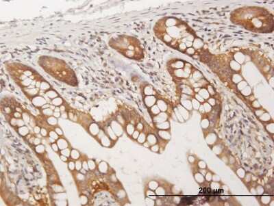 Immunohistochemistry-Paraffin: CC2D1A Antibody [H00054862-B01P] - Analysis of purified antibody to CC2D1A on formalin-fixed paraffin-embedded human small Intestine. (antibody concentration 3 ug/ml)