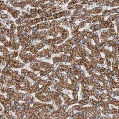 Immunohistochemistry-Paraffin: CC2D1A Antibody [NBP1-83666] - Staining of human liver shows strong cytoplasmic positivity in hepatocytes.