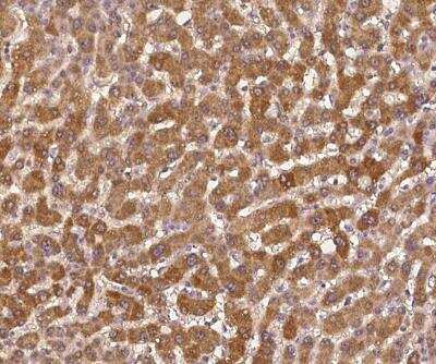 Immunohistochemistry-Paraffin: CC2D1A Antibody [NBP3-12658] -  Staining of human CC2D1A in human liver with rabbit polyclonal antibody at 1:100 dilution.