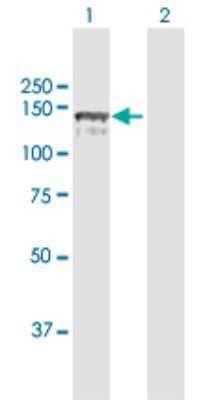 Western Blot: CC2D1A Antibody [H00054862-D01P] - Analysis of CC2D1A expression in transfected 293T cell line by CC2D1A polyclonal antibody.Lane 1: CC2D1A transfected lysate(104.10 KDa).Lane 2: Non-transfected lysate.