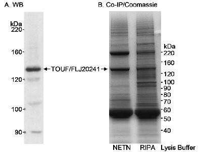 Western Blot: CC2D1A Antibody [NB500-255] - Detection of Human TOUF/FLJ20241 on HeLa whole cell lysate using NB500-255.