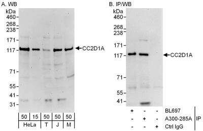 Western Blot: CC2D1A Antibody [NB500-255] - Whole cell lysate from HeLa (15 and 50 ug for WB; 1 mg for IP, 20% of IP loaded), 293T (T; 50 ug), Jurkat (J; 50 ug) and mouse NIH3T3 (M; 50 ug) cells