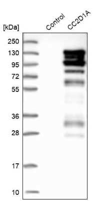 Western Blot: CC2D1A Antibody [NBP1-83666] - Analysis in control (vector only transfected HEK293T lysate) and CC2D1A over-expression lysate (Co-expressed with a C-terminal myc-DDK tag (3.1 kDa) in mammalian HEK293T cells).