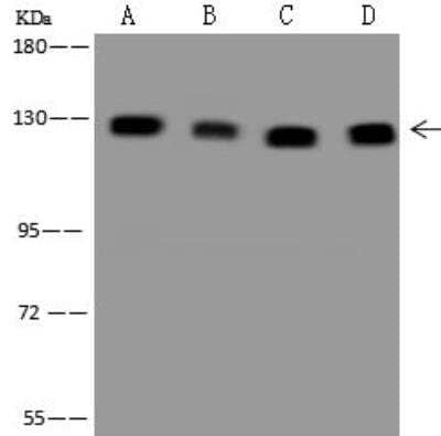 Western Blot: CC2D1A Antibody [NBP3-12658] - Lane A: Hela Whole Cell LysateLane B: HEK-293 Whole Cell LysateLane C: Jurkat Whole Cell LysateLane D: MCF7 Whole Cell LysateLysates/proteins at 30 ug per lane.SecondaryGoat Anti-Rabbit IgG (H+L)/HRP at 1/10000 dilution.Developed using the ECL technique.Performed under reducing conditions.Predicted band size:104 kDaObserved band size:130 kDa