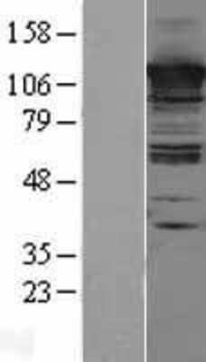 Western Blot: CC2D1A Overexpression Lysate (Adult Normal) [NBL1-08754] Left-Empty vector transfected control cell lysate (HEK293 cell lysate); Right -Over-expression Lysate for CC2D1A.