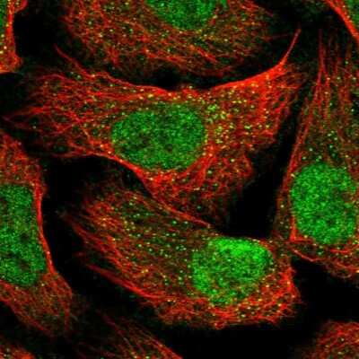 Immunocytochemistry/ Immunofluorescence CC2D1B Antibody