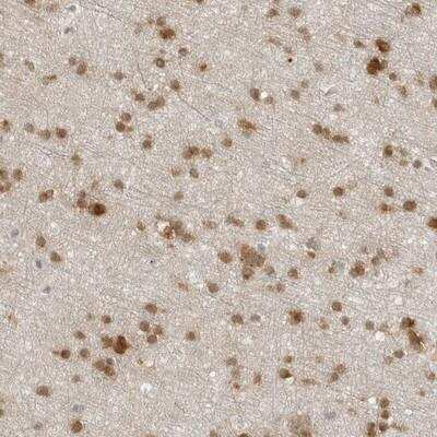 Immunohistochemistry-Paraffin: CC2D1B Antibody [NBP1-81369] - Staining of human cerebral cortex shows moderate nuclear and cytoplasmic positivity in glial cells.