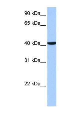 Western Blot: CC2D1B Antibody [NBP1-52841] - Human Placenta lysate, concentration 0.2-1 ug/ml.