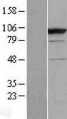 Western Blot: CC2D1B Overexpression Lysate (Adult Normal) [NBL1-08755] Left-Empty vector transfected control cell lysate (HEK293 cell lysate); Right -Over-expression Lysate for CC2D1B.