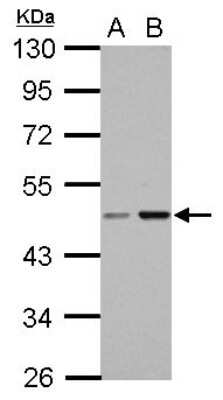 Western Blot: CC2D2B Antibody [NBP2-15738] - Sample (30 ug of whole cell lysate) A: NT2D1 B: PC-3 10% SDS PAGE gel, diluted at 1:1000.