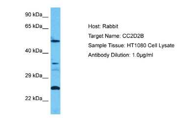 Western Blot: CC2D2B Antibody [NBP2-87136] - Host: Rabbit. Target Name: CC2D2B. Sample Type: HT1080 Whole Cell lysates. Antibody Dilution: 1.0ug/ml