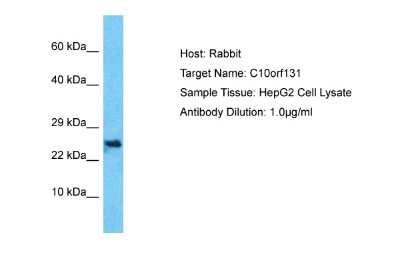 Western Blot: CC2D2B Antibody [NBP2-87137] - Host: Rabbit. Target Name: C10orf131. Sample Type: HepG2 Whole Cell lysates. Antibody Dilution: 1.0ug/ml