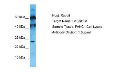 Western Blot: CC2D2B Antibody [NBP2-87138] - Host: Rabbit. Target Name: C10orf131. Sample Type: PANC1 Whole Cell lysates. Antibody Dilution: 1.0ug/ml