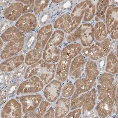 Immunohistochemistry-Paraffin: CCBL1 Antibody [NBP1-83315] - Staining of human kidney shows moderate cytoplasmic positivity in cells in tubules.