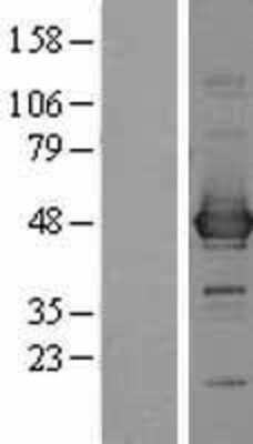 Western Blot Cysteine Conjugate beta-Lyase/CCBL1 Overexpression Lysate
