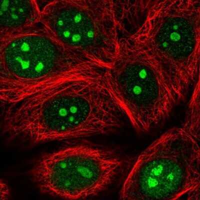 Immunocytochemistry/Immunofluorescence: CCDC101 Antibody [NBP2-38670] - Immunofluorescent staining of human cell line MCF7 shows localization to nucleus & nucleoli.