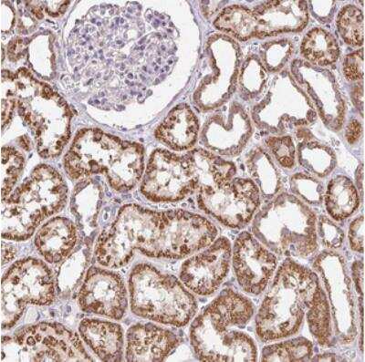 Immunohistochemistry CCDC101 Antibody