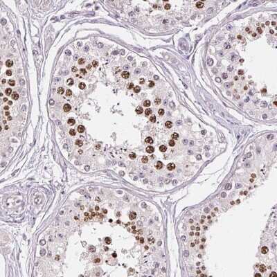 Immunohistochemistry-Paraffin: CCDC101 Antibody [NBP2-38670] - Staining of human testis shows high expression.