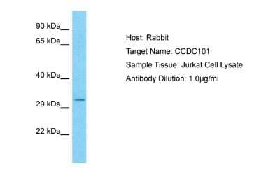 Western Blot: CCDC101 Antibody [NBP2-84594] - Host: Rabbit. Target Name: CCDC101. Sample Type: Jurkat Whole Cell lysates. Antibody Dilution: 1.0ug/ml