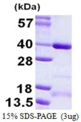 SDS-PAGE Recombinant Human CCDC101 His Protein