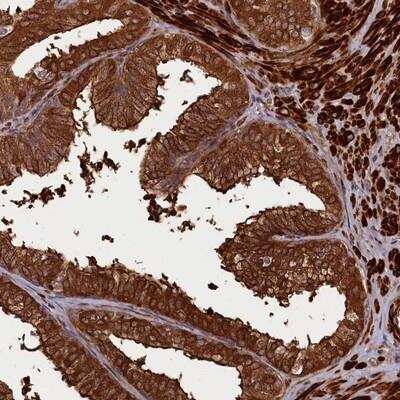Immunohistochemistry-Paraffin: CCDC102A Antibody [NBP1-82765] - Staining of human prostate shows strong cytoplasmic positivity in glandular cells.