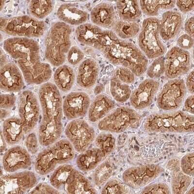 Immunohistochemistry: CCDC102B Antibody [NBP2-38575] - Staining of human kidney shows strong cytoplasmic, nuclear and membranous positivity in cells in kidney tubules.